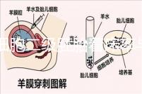 6細胞二級胚胎著床率與養(yǎng)囊成功率解讀，拿不準移植與否戳
