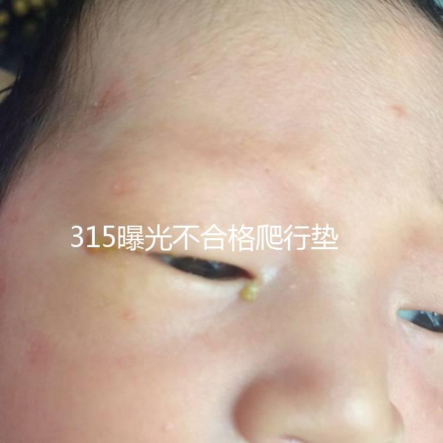 315曝光不合格爬行墊品牌,甲酰胺超標(biāo)的危害可不小