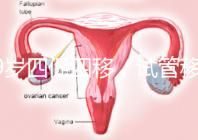 39歲四促四移，試管移植失敗5次后應(yīng)該怎么辦？