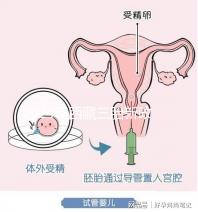 2024年西藏三胎新政策出臺，拉薩、日喀則產假戳多久？