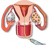 2024武漢免費葉酸外國人可以領(lǐng)取,符合條件就來江漢區(qū)